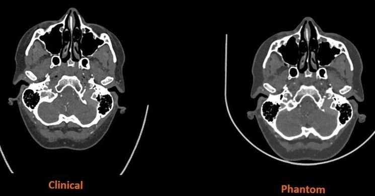Innováció az egészségügyi technológiában: a 3D nyomtatás új területei