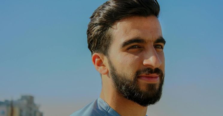 FUE hajbeültetés: az önbizalom erősítésének új módja